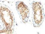 Ornithine Decarboxylase-1 (ODC-1) Antibody in Immunohistochemistry (Paraffin) (IHC (P))