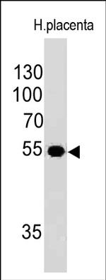 Ornithine Decarboxylase-1 (ODC-1) Antibody in Western Blot (WB)