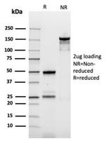 Ornithine Decarboxylase-1 (ODC-1) Antibody in SDS-PAGE (SDS-PAGE)