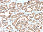 Ornithine Decarboxylase-1 (ODC-1) Antibody in Immunohistochemistry (Paraffin) (IHC (P))