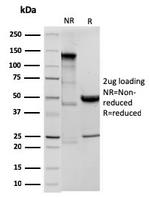 Ornithine Decarboxylase-1 (ODC-1) Antibody in SDS-PAGE (SDS-PAGE)