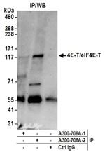 4E-T/eIF4E-T Antibody in Western Blot (WB)