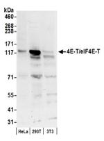 4E-T/eIF4E-T Antibody in Western Blot (WB)