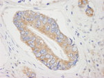 4E-T/eIF4E-T Antibody in Immunohistochemistry (IHC)