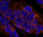 4E-T/eIF4E-T Antibody in Immunohistochemistry (IHC)