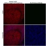 CD20 Antibody in Immunohistochemistry (Paraffin) (IHC (P))