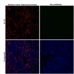 Ki-67 Antibody in Immunohistochemistry (Paraffin) (IHC (P))