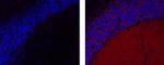 Synaptophysin Antibody in Immunohistochemistry (Paraffin) (IHC (P))