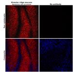 Pan Cytokeratin Antibody in Immunohistochemistry (Paraffin) (IHC (P))