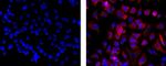 Pan Cytokeratin Antibody in Immunocytochemistry (ICC/IF)