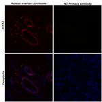 Alpha-Smooth Muscle Actin Antibody in Immunohistochemistry (Paraffin) (IHC (P))