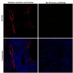 Alpha-Smooth Muscle Actin Antibody in Immunohistochemistry (Paraffin) (IHC (P))