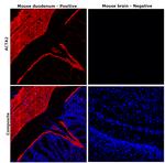 Alpha-Smooth Muscle Actin Antibody in Immunohistochemistry (Paraffin) (IHC (P))