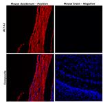 Alpha-Smooth Muscle Actin Antibody in Immunohistochemistry (Paraffin) (IHC (P))