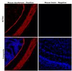 Alpha-Smooth Muscle Actin Antibody in Immunohistochemistry (Paraffin) (IHC (P))