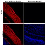 Alpha-Smooth Muscle Actin Antibody in Immunohistochemistry (Paraffin) (IHC (P))