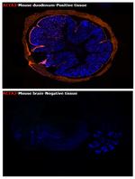 Alpha-Smooth Muscle Actin Antibody in Immunohistochemistry (Paraffin) (IHC (P))