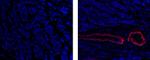 Alpha-Smooth Muscle Actin Antibody in Immunohistochemistry (Paraffin) (IHC (P))