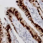 PID/MTA2 Antibody in Immunohistochemistry (Paraffin) (IHC (P))