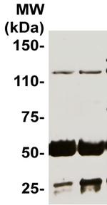 Telomerase Antibody in Western Blot (WB)