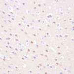 amyloid Antibody in Immunohistochemistry (Paraffin) (IHC (P))