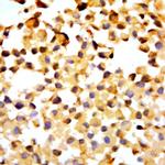 Phospho-ELK1 (Thr417) Antibody in Immunocytochemistry (ICC/IF)