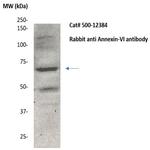 Annexin VI Antibody in Western Blot (WB)