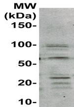 Collagen I Antibody in Western Blot (WB)