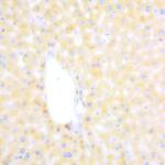 Hepatitis B virus core Ag Antibody in Immunohistochemistry (Paraffin) (IHC (P))