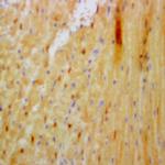 Hepatitis B virus surface Ag Antibody in Immunohistochemistry (Paraffin) (IHC (P))