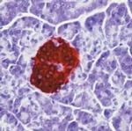 Insulin Antibody in Immunohistochemistry (Paraffin) (IHC (P))