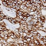 Cadherin (pan) Antibody in Immunohistochemistry (Paraffin) (IHC (P))