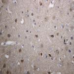 Synuclein beta Antibody in Immunohistochemistry (Paraffin) (IHC (P))