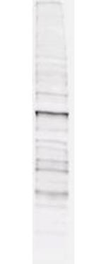 Phosphothreonine Antibody in Western Blot (WB)