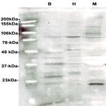 hGH Antibody in Western Blot (WB)