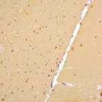 Presenilin Antibody in Immunohistochemistry (Paraffin) (IHC (P))