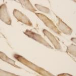 TGF-beta 2 Antibody in Immunohistochemistry (Paraffin) (IHC (P))