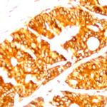 Claudin 3 Antibody in Immunohistochemistry (Paraffin) (IHC (P))