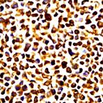 MMP-14 Antibody in Immunocytochemistry (ICC/IF)