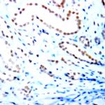 Estrogen Receptor beta (ER beta) Antibody in Immunohistochemistry (Paraffin) (IHC (P))