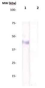 Estrogen Receptor beta (ER beta) Antibody in Western Blot (WB)