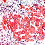 Alpha Fetoprotein (AFP) Antibody in Immunohistochemistry (Paraffin) (IHC (P))