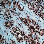 Androgen Receptor (AR) Antibody in Immunohistochemistry (Paraffin) (IHC (P))