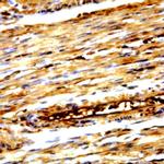 c-erbB-4/HER-4 Antibody in Immunohistochemistry (Paraffin) (IHC (P))