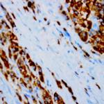 S100 Antibody in Immunohistochemistry (PFA fixed) (IHC (PFA))