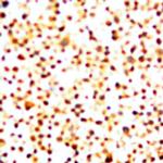 Cyclin A Antibody in Immunocytochemistry (ICC/IF)