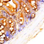 Mekk-1 Antibody in Immunohistochemistry (Paraffin) (IHC (P))