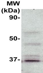 MyD88 Antibody in Western Blot (WB)