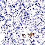 Eotaxin Antibody in Immunohistochemistry (Paraffin) (IHC (P))