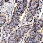 MMP-8 Antibody in Immunohistochemistry (Paraffin) (IHC (P))